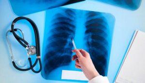 Пересувний флюорограф