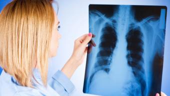 Пересувний флюорограф: мешканці громади зможуть пройти безкоштовне обстеження
