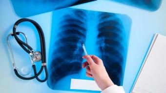 Пересувний флюорограф: мешканці громади зможуть пройти безкоштовне обстеження